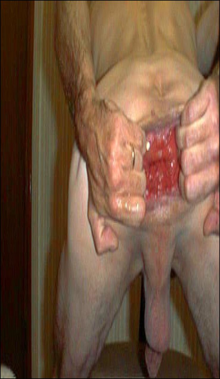 Goatse pic
